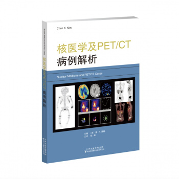 t(y)W(xu)PET/CT